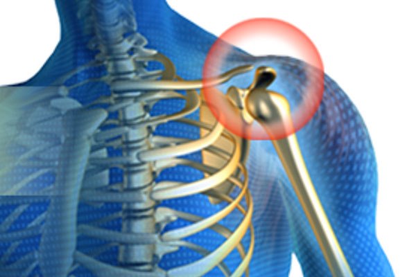 肩鎖関節脱臼の治療 手術 リハビリ テーピング サポーター全知識